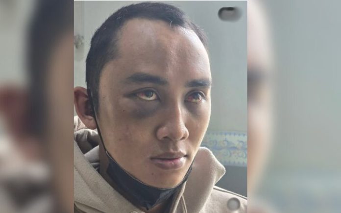 ASN (1) Sering Dianiaya Istri, ASN Ini Kabur dari Rumah calvin