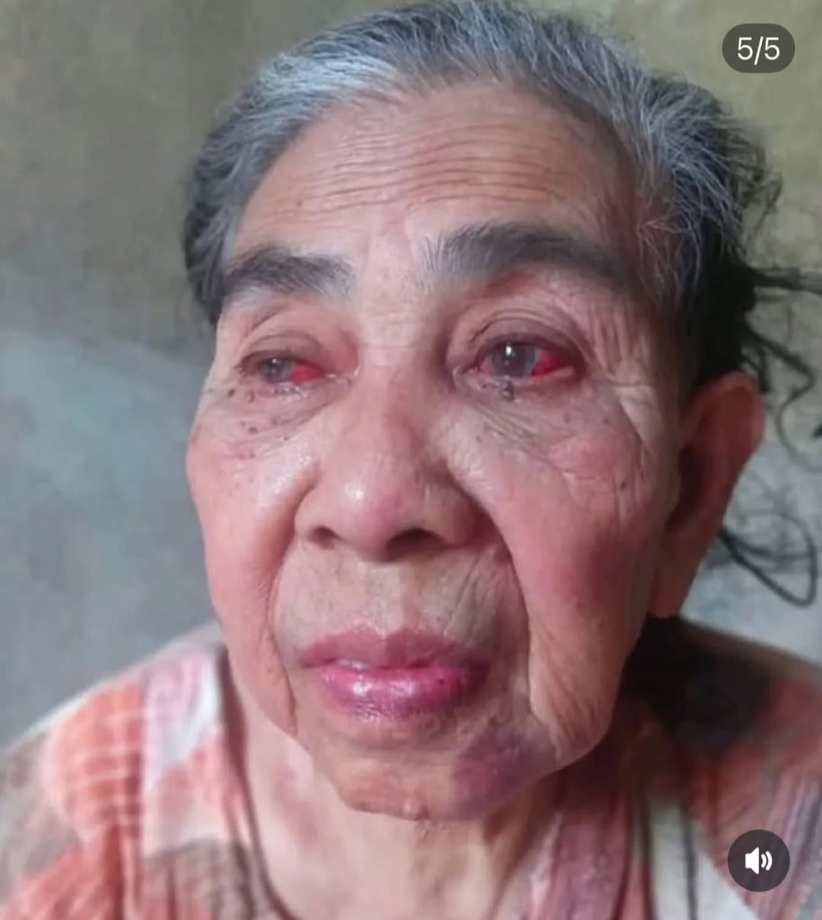 Dituduh Penculik Anak, Nenek Asyah Remuk Dianiaya 2 “Iblis”