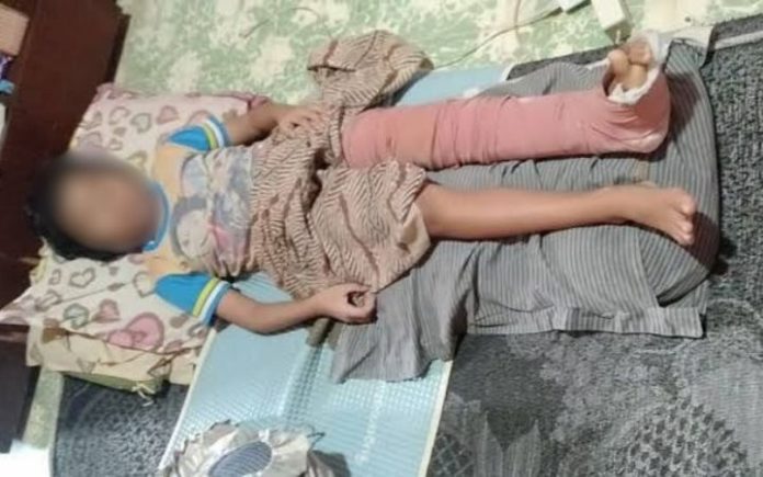 korban tabrak lari Usai Tabrak Bocah 5 Tahun, Ibu Penunggang Vario di Langsa Melarikan Diri