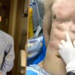 Terobsesi Perut Six-Pack Instan, Influencer China Ini Bayar Rp9 M Untuk Suntik Hialuronat Terobsesi Perut Six-Pack Instan, Influencer China Ini Bayar Rp9 M Untuk Suntik Hialuronat