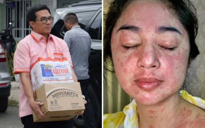 Ketua DPRK Banda Aceh: Suara Korban Banjir Aceh Bukan Kebisingan