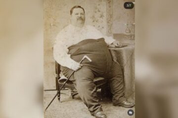 Chauncey Morlan, “Human Freight Car” yang Tubuhnya Dijadikan Tontonan