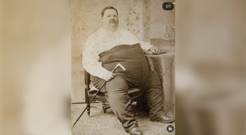 Chauncey Morlan, “Human Freight Car” yang Tubuhnya Dijadikan Tontonan